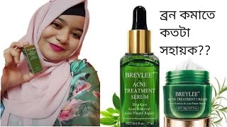 আসলেই কি ব্যবহারে ব্রন যাবে breylee acne treatment sirum and cream breleey cream review [upl. by Irahcaz]