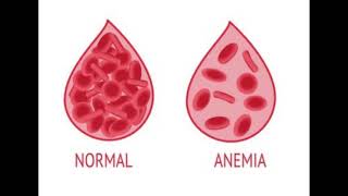 Prevención De La Anemia Y Alimentación Saludable PÓDCAST [upl. by Millar453]