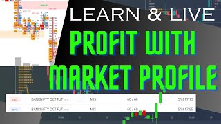 Market profile trading Profit  Market profile trading strategies  market profile live trading [upl. by Binette]