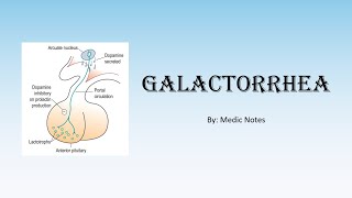 Prolactinoma mcq [upl. by Torres178]