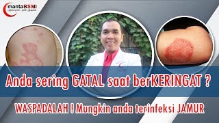 Gatal selangkangan  GATAL saat berKERINGAT  Kulit anda JAMURAN [upl. by Kalman]