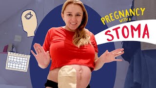 Pregnancy Vs Stoma my experience pregnant with an ileostomy [upl. by Nimrac701]