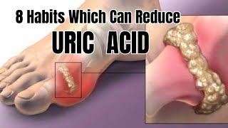 8 Habits Which can Reduce URIC ACID [upl. by Durr]