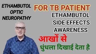 टीबी की दवा और आखो से कम दिखाई देनाETHAMBUTOL TOXICITY SIDE EFFECTS OF ETHAMBUTOL [upl. by Acinna599]