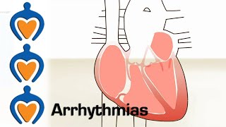 Arrhythmia overview  Types  Diagnosis and treatment [upl. by Asare862]