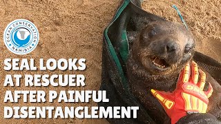 Seal Looks at His Rescuer After Painful Disentanglement [upl. by Laband750]