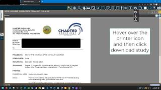 How to Download Reports and Exams from Charter Radiology [upl. by Nawuq]