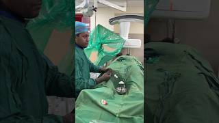 देखिए कैसे होता है वैरिकोसेल का इलाज  Live Varicocele Embolization shortsfeed2024 livesurgeryroom [upl. by Aicsila]