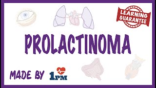 Prolactinoma  Pathology Symptoms Diagnosis Treatment [upl. by Sinne]