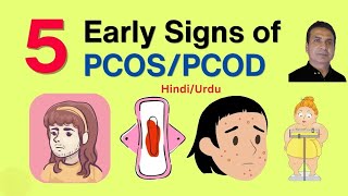 PCOS Symptoms amp Treatment Options pcos PolcysticOvarianSyndrome drabbasofficial [upl. by Burrell885]