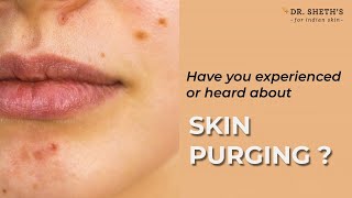 How to Check for Skin Purging [upl. by Lawford]