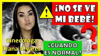 ⚠SACO GESTACIONAL SIN BEBÉ❗ ¿Hasta cuando es NORMAL❓ por GINECOLOGA DIANA ALVAREZ [upl. by Devona60]