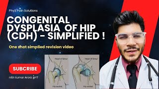 Barlow amp Ortolani test Congenital Hip Dislocation Everything You Need To Know  Dr Ishant Arora [upl. by Alvan]