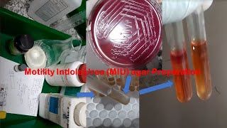 MIU Test Medium Preparation in Laboratory and inoculation of Test organism [upl. by Idet]