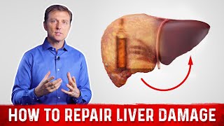 How To Repair Liver Damage After Alcohol – DrBerg on Liver Cirrhosis [upl. by Asiil805]