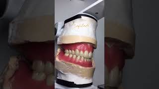 👉🏼 Enfilado bimaxilar con ⁠Ivoclarglobal dentist [upl. by Weismann942]