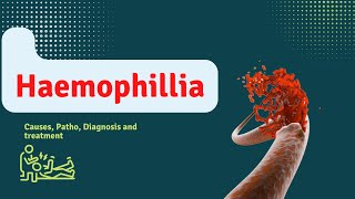 Hemophilia Causes Diagnosis and Treatment [upl. by Eniroc]