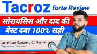 Tacroz Forte Ointment Review  Tacrolimus Ointment Uses Mode Of Action amp Side Effects In Hindi [upl. by Nido]