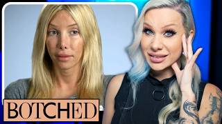 BOTCHED Is 24 trans plastic surgeries too many volume 3 [upl. by Nosreip]