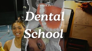 A WEEK IN DENTAL SCHOOL  2nd year [upl. by Nohtanhoj]