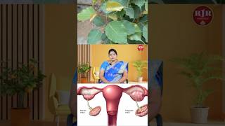 நீர்க்கட்டியை சரி செய்யும் அரச இலை 😲 Pcod natural remedy [upl. by Windzer]