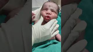 essential care after birth baby nicu newborn cute [upl. by Ettennat]