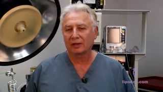 Laser Liposuction Dr Leon Forrester Tcheupdjian MD [upl. by Deerdre]