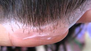 Complete hair solutionscouk Affordable non surgical hair replacementMr Blue sky [upl. by Saticilef]