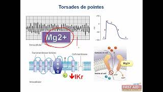 Torsades de pointes pathology video part 4 from USMLE First Aid Step one [upl. by Aicirt]