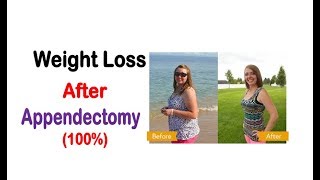 Weight Loss After Appendectomy  How To Lose Weight After Appendix RemovalSurgery [upl. by Rhoda]