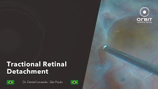 Orbit Tips 060  Tractional Retinal Detachment [upl. by Butte]