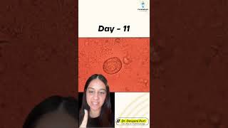 Welcome to today’s Micro Mystery  Can you crack this case  Day 11  Dr Devyani Puri [upl. by Gena]