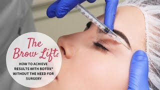 The Brow Lift How to Achieve Results with BOTOX® without the need for Surgery [upl. by Cerallua]