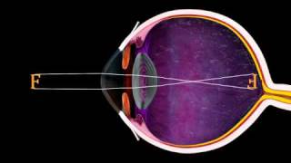 The Eye and Focus  3D Medical Animation  ABP © [upl. by Nash]