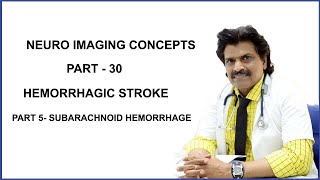 NEUROIMAGING CONCEPTS PART  30HEMORRHAGIC STROKEPART 5 SUBARACHNOID HEMORRHAGE [upl. by Naellij386]