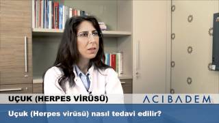 Uçuk Herpes Virüsü nasıl tedavi edilir [upl. by Ettore]