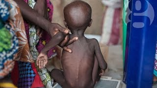 Nigeria on the brink of famine Children are dying from starvation [upl. by Nakah]