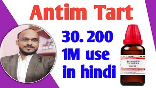 Antim tart 302001m use in hindi  Antim tart homeopathic medicine  Antim tart 30 benefits [upl. by Culley481]