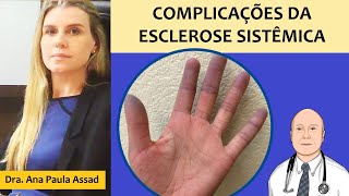 Complicações da esclerose sistêmica no coração pulmões rins intestinos e outros locais do corpo [upl. by Anissej]