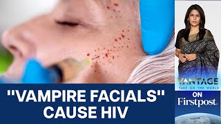 Three Women Infected with HIV After quotVampire Facialsquot US  Vantage with Palki Sharma [upl. by Anirda905]