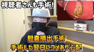 【胆嚢摘出手術】視聴者さんも手術痛む中でコメくれて心配1日でも早く元気になる事を心から祈ってます [upl. by Lamek]