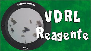 Teste de VDRL Reagente  Visto ao microscópio [upl. by Trevah]