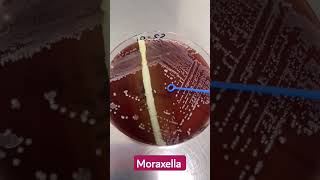 Microbiology lab diagnosis of Moraxella intact colonies [upl. by Warila]