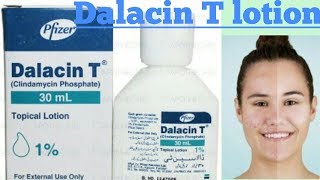 Dalacin T lotion [upl. by Yehus]