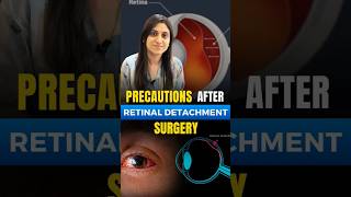 Precautions After Retinal Detachment Surgery [upl. by Lynea]