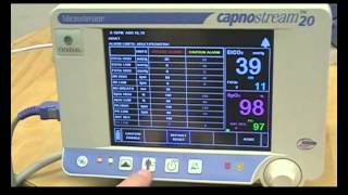 Capnostream 20 end tidal bedside monitor [upl. by Colleen]