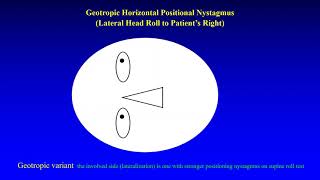 Geotropic and Apogeotropic Horizontal Positional Nystagmus [upl. by Wendell]