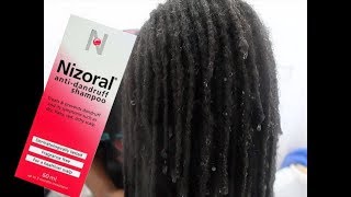 NIZORAL ANTI DANDRUFF SHAMPOO FIRST IMPRESSIONS HMMMMMM [upl. by Spiegelman105]