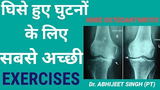 KNEE ARTHRITIS PAIN EXERCISES HINDI  KNEE PAIN EXERCISES HINDI  KNEE OSTEOARTHRITIS PAIN RELIEF [upl. by Annor]