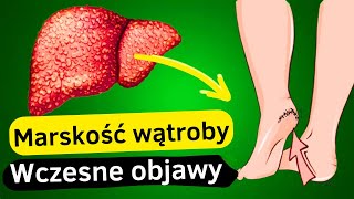 12 Pierwszych Objawów Uszkodzenia Wątroby  Przewodnik po Zdrowiu Wątroby [upl. by Daile]